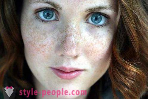 Kako da biste dobili osloboditi od freckles? Najbolje vrhnje i narodnih lijekova za pjegice