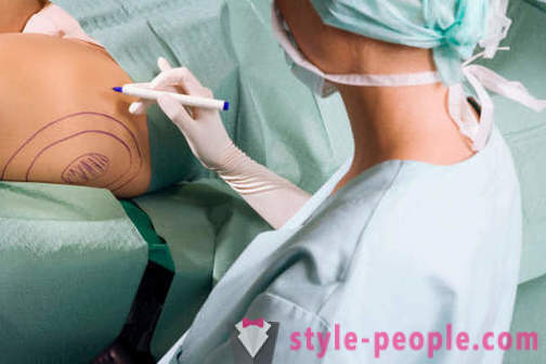 Plastični kirurzi uništiti stereotipe o svom radu