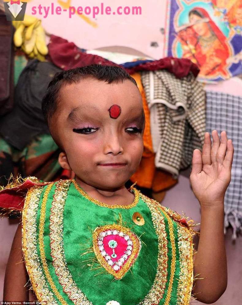 Indijski selo obožavaju dječaka s deformiranom glavom kao boga Ganesha