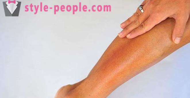 Suha koža na nogama: Uzroci