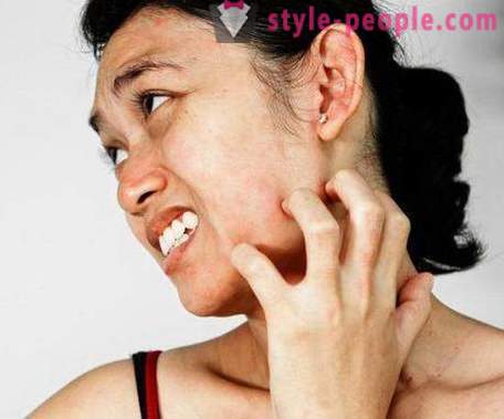 Kako ukloniti iritacije na licu
