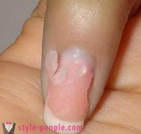 Kako ukloniti akril nokte kod kuće? Uklanjanje akril nokte: recenzije